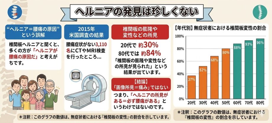 椎間板の変性を年代別に表したグラフ
