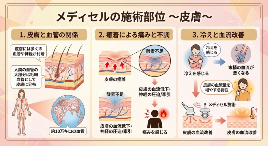 メディセルの施術部位。皮膚についてまとめた画像。