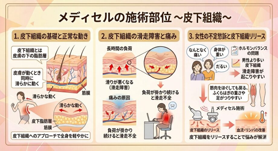 メディセルの施術部位。皮下組織についてまとめた画像。