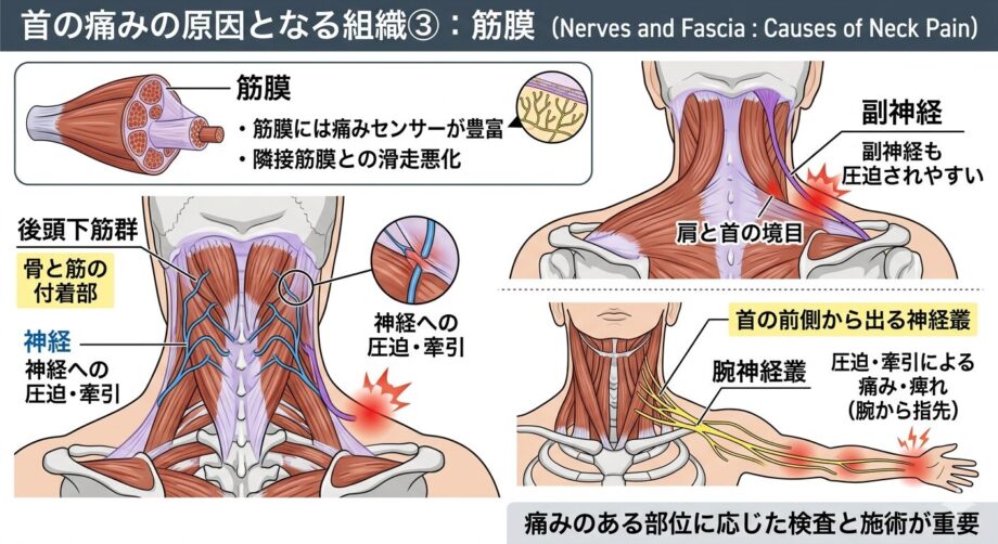 首の痛みの原因となる組織③　筋膜をまとめた画像。