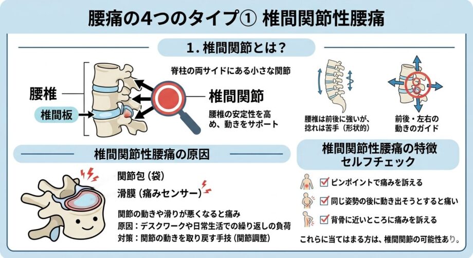 椎間関節の特徴をまとめた画像。