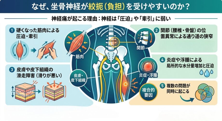 神経が圧迫される理由をまとめたインフォグラフィック。
