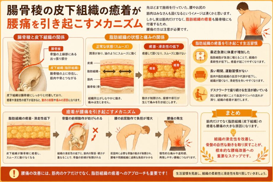 皮下組織の癒着が腰痛を引き起こすインフォグラフィック。