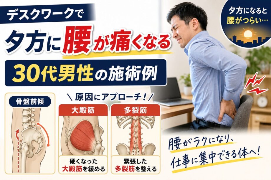 デスクワークで夕方に腰が痛くなる30代男性の施術例　骨盤前傾・大殿筋・多裂筋へのアプローチのサムネイル画像。