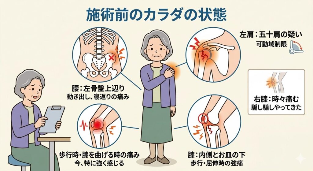 施術前のカラダの状態をまとめた画像。