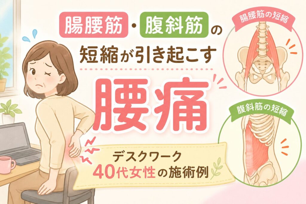 腸腰筋・腹斜筋の短縮が引き起こす腰痛 デスクワーク40代女性の施術例【柔道整復師が解説】サムネイル画像。