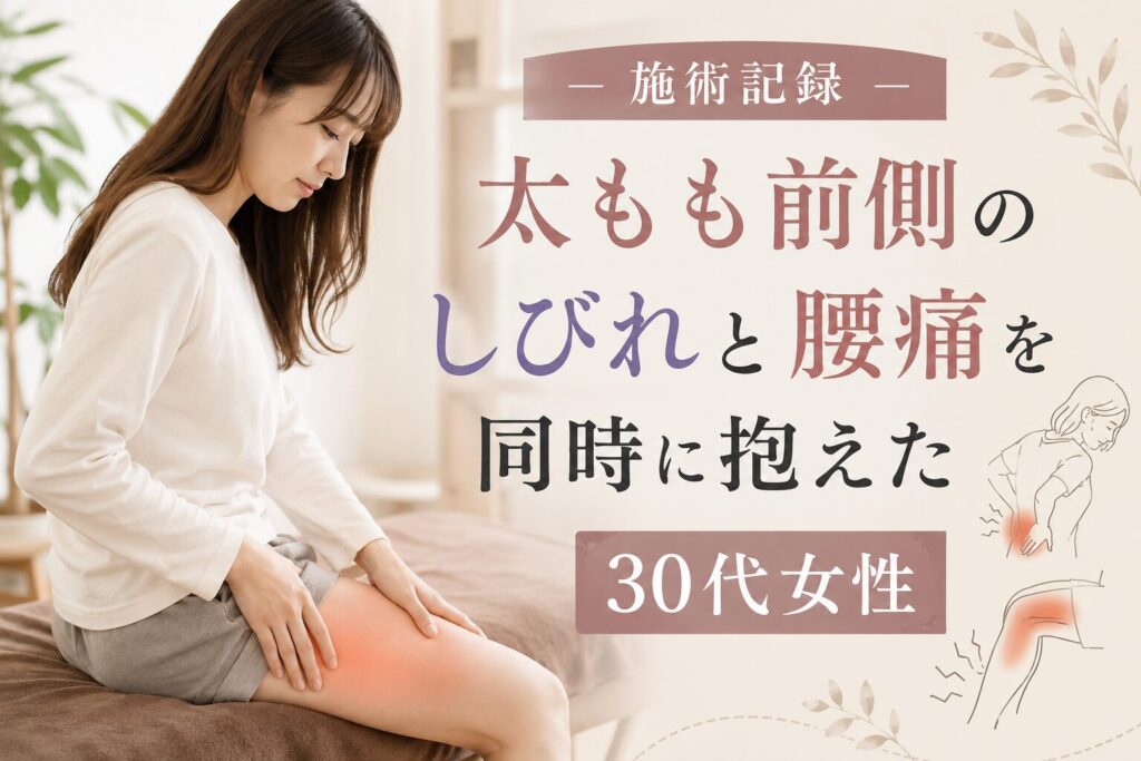 太もも前側のしびれと腰痛を同時に抱えた30代女性の施術記録 上野・稲荷町の整体院urokoBodyCareのサムネイル画像。