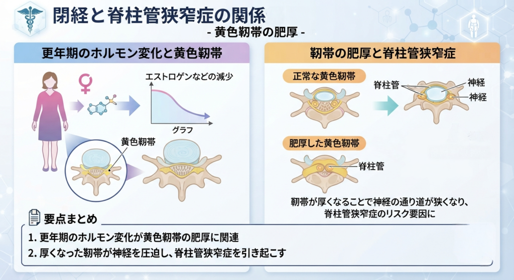 黄色靭帯の肥厚と脊柱管狭窄症をまとめたイラスト