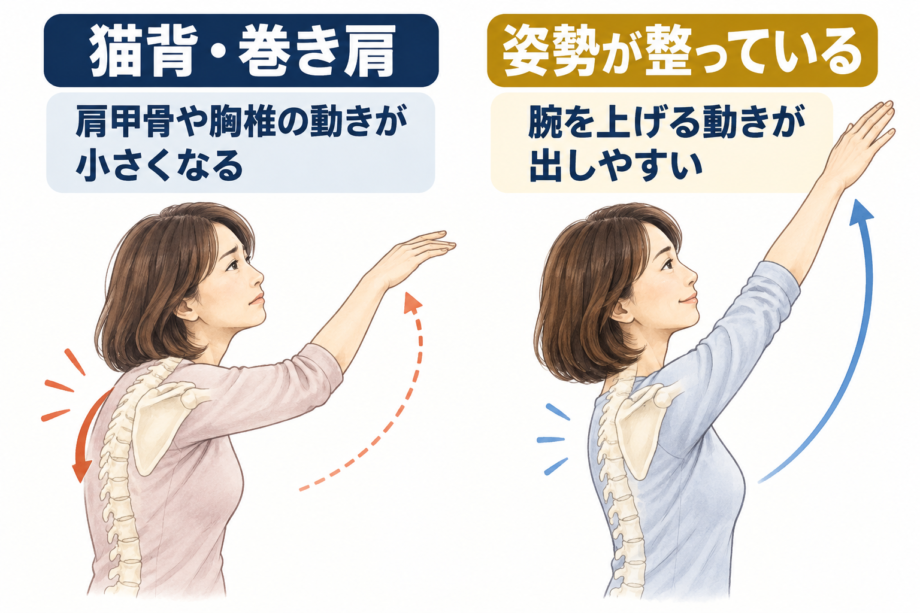 猫背になると肩が上がりづらくなる理由